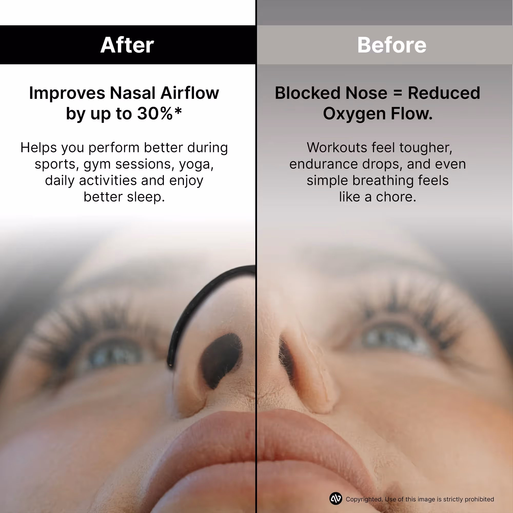 BreatheX Nasal Strip image 3